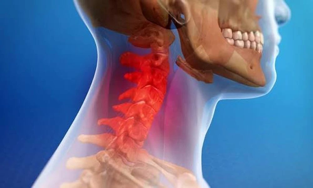 Why Whiplash Symptoms May Appear Hours or Days After a Northern Ireland Car Accident